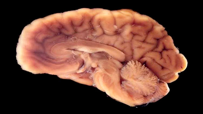 العلماء يطورون أدمغة بشرية في المختبر