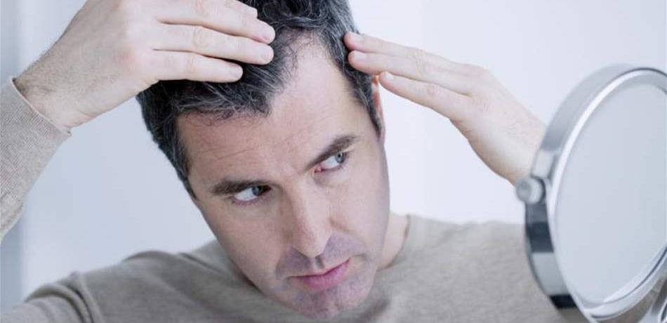 5 عادات خاطئة تسرع ظهور الشَّيْب.. تجنّبوها!