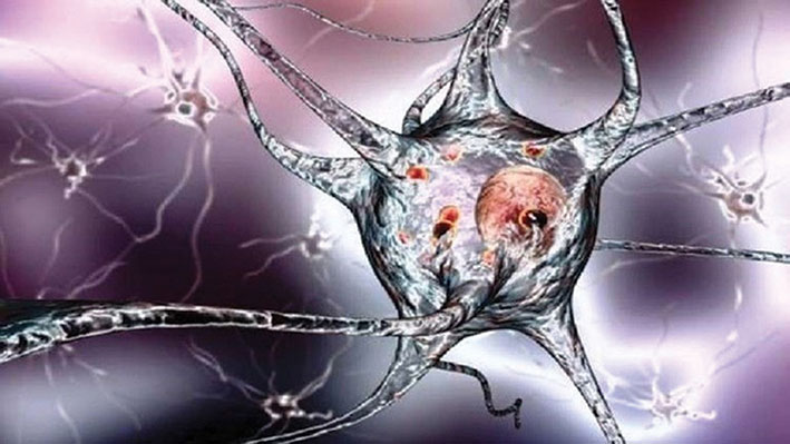 أدلة جديدة تثبت أن مرض الشلل الرعاش يبدأ من الأمعاء