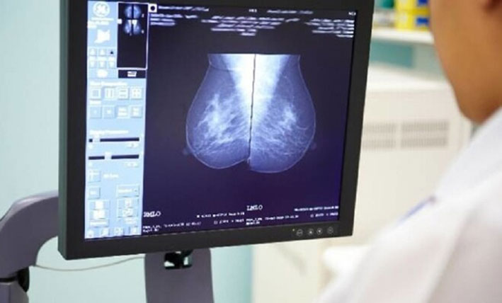 جرعة إشعاع واحدة بدلا من أسابيع علاج إشعاعي لسرطان الثدي