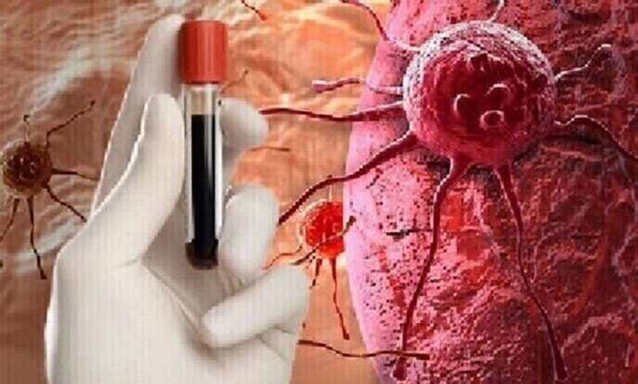 أمراض قد تسبب تطور السرطان