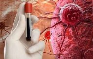 أمراض قد تسبب تطور السرطان