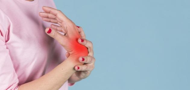 الأعراض الرئيسية لالتهاب المفاصل في اليدين
